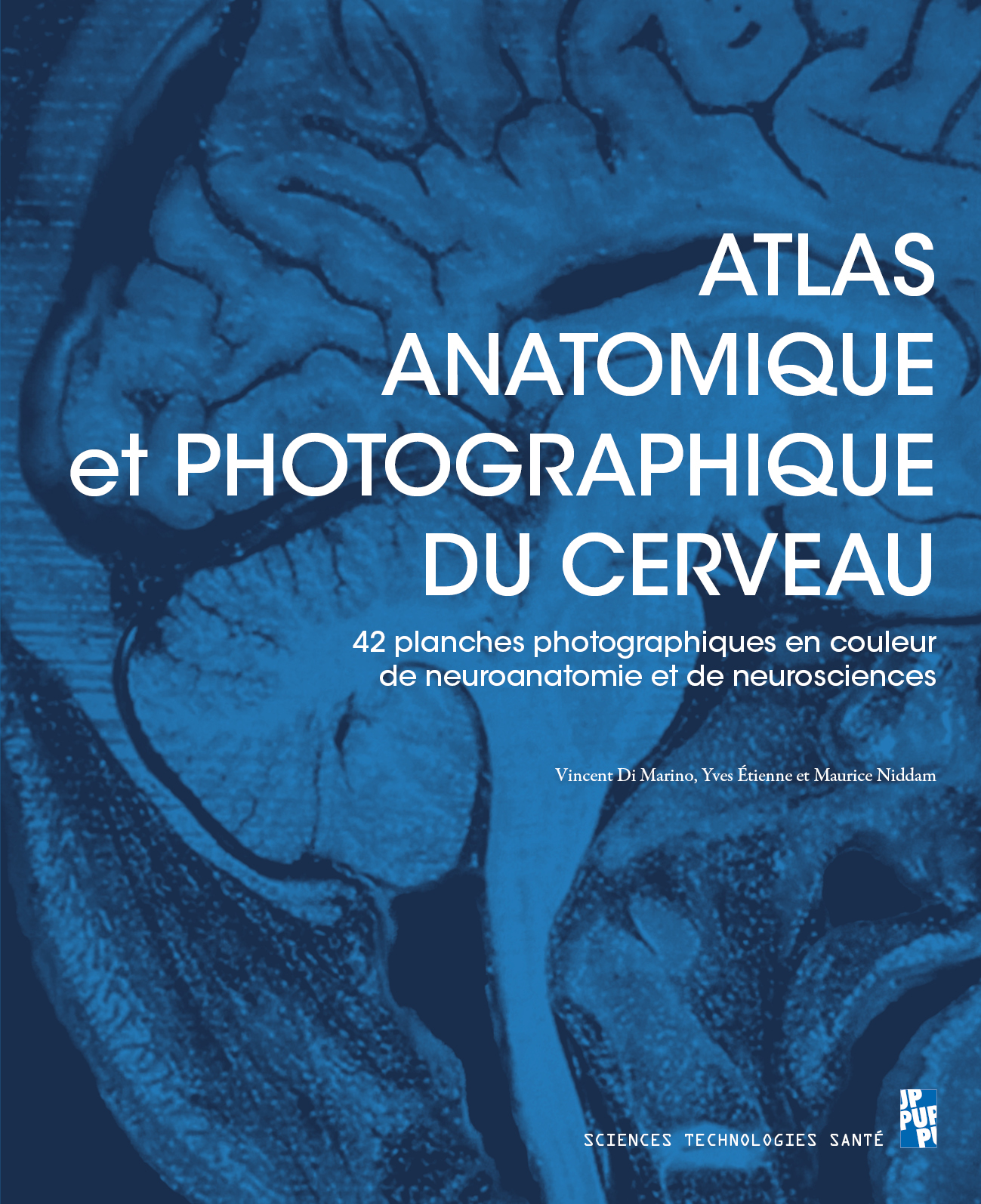 Photo de couverture du livre Atlas anatomique et photographique du cerveau par Vincent Di Marino aux Presses Universitaires de Provence.