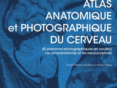 Photo de couverture du livre Atlas anatomique et photographique du cerveau par Vincent Di Marino aux Presses Universitaires de Provence.